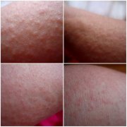 ����Ƥ��������ԭ������Щ