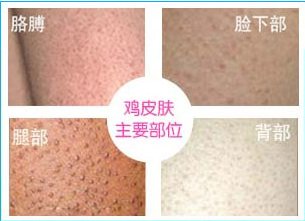 ��������ë�ܽǻ��ļ�ҽԺ�ȽϺ�