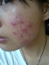 �����ഺ�����ճ�С����