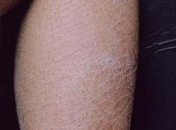 ���۲��Ƿ�����Ŵ�